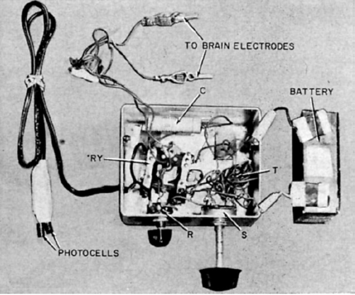 Button's stimulating apparatus was connected to an array of four stainless steel wires implanted in the occipital cortex of a blind woman