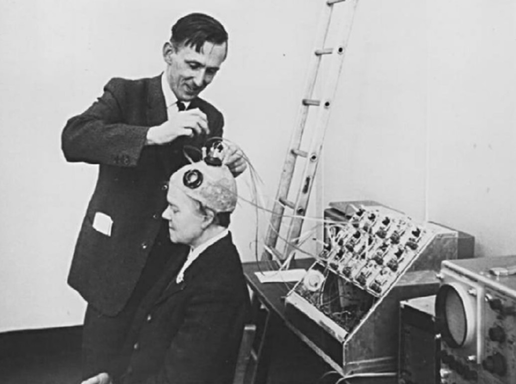 Brindley stimulating the visual cortex of his first implant recipient, placing a stimulating coil over a matched receiving coil implanted under her scalp