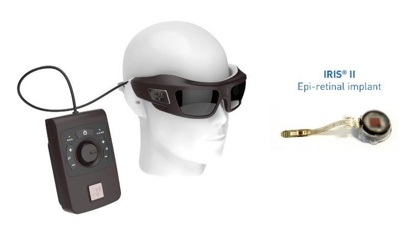 bionic-vision.org | Implants | IRIS II